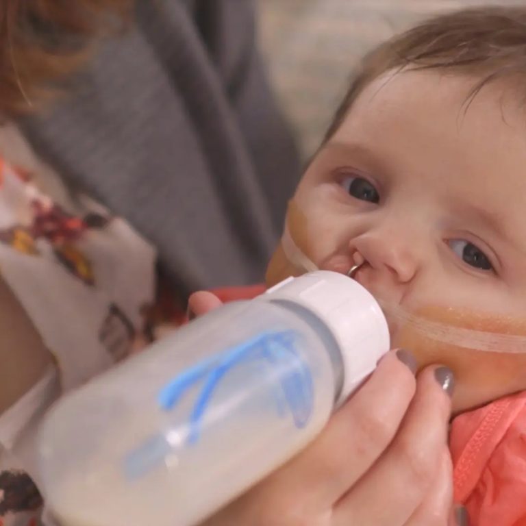 Mamadera Alimentación Especial 120ml (labio leporino, palar hendido, etc.) Dr. Brown's